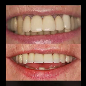 Home | West Ajax dental 17 home-page-beforeandafter1-288x288