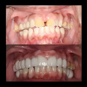 Home | West Ajax dental 26 home-page-beforeandafter13-288x288