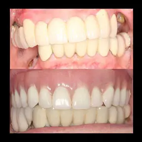 Home | West Ajax dental 28 home-page-beforeandafter15-288x288