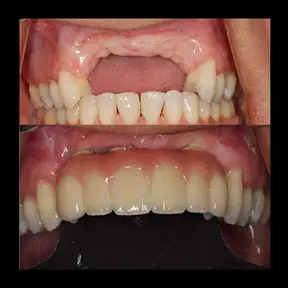 Home | West Ajax dental 29 home-page-beforeandafter16-288x288