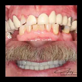 Home | West Ajax dental 30 home-page-beforeandafter18-288x288