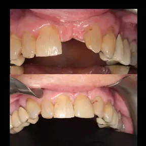 Home | West Ajax dental 18 home-page-beforeandafter2-288x288