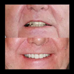 Home | West Ajax dental 19 home-page-beforeandafter3-288x288