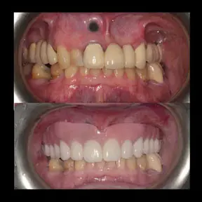 Home | West Ajax dental 20 home-page-beforeandafter4-288x288