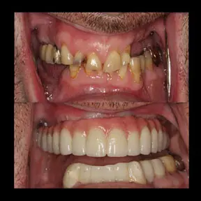 Home | West Ajax dental 21 home-page-beforeandafter5-288x288