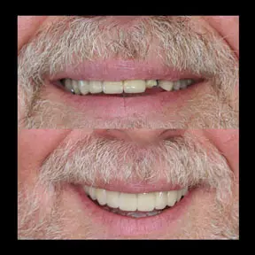 Home | West Ajax dental 23 home-page-beforeandafter7-288x288