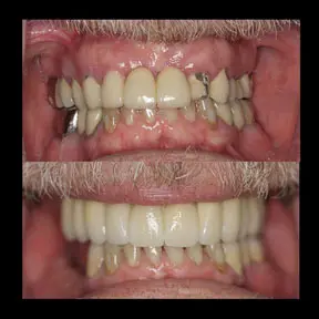 Home | West Ajax dental 24 home-page-beforeandafter8-288x288