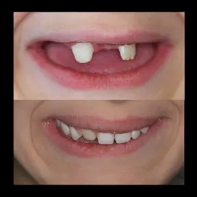 Home | West Ajax dental 25 home-page-beforeandafter9-288x288