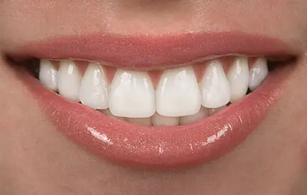 Cosmetic Dentist in Ajax Cosmetic Dentist in Ajax